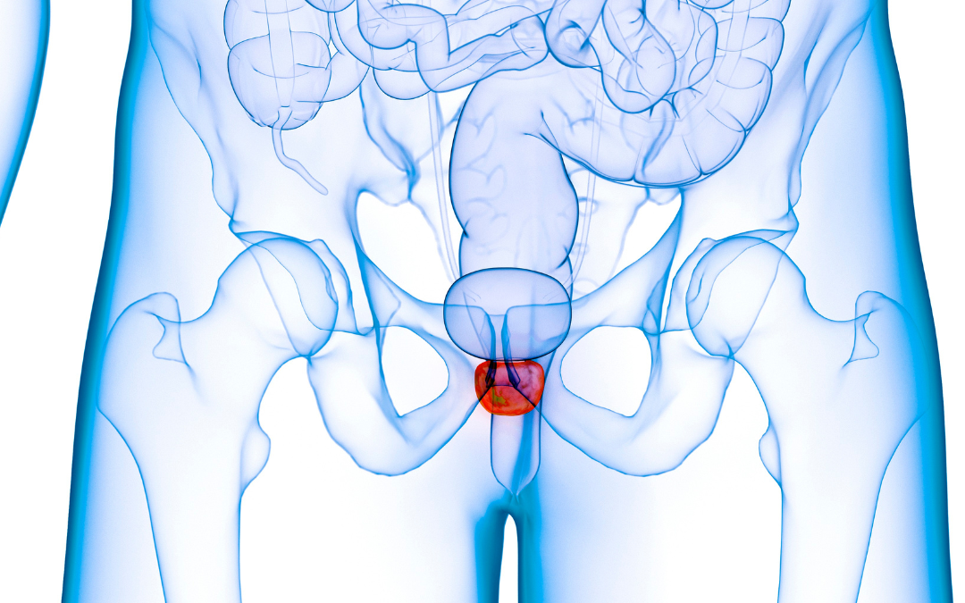 Prirodna pomoć za povećanu prostatu i rak prostate